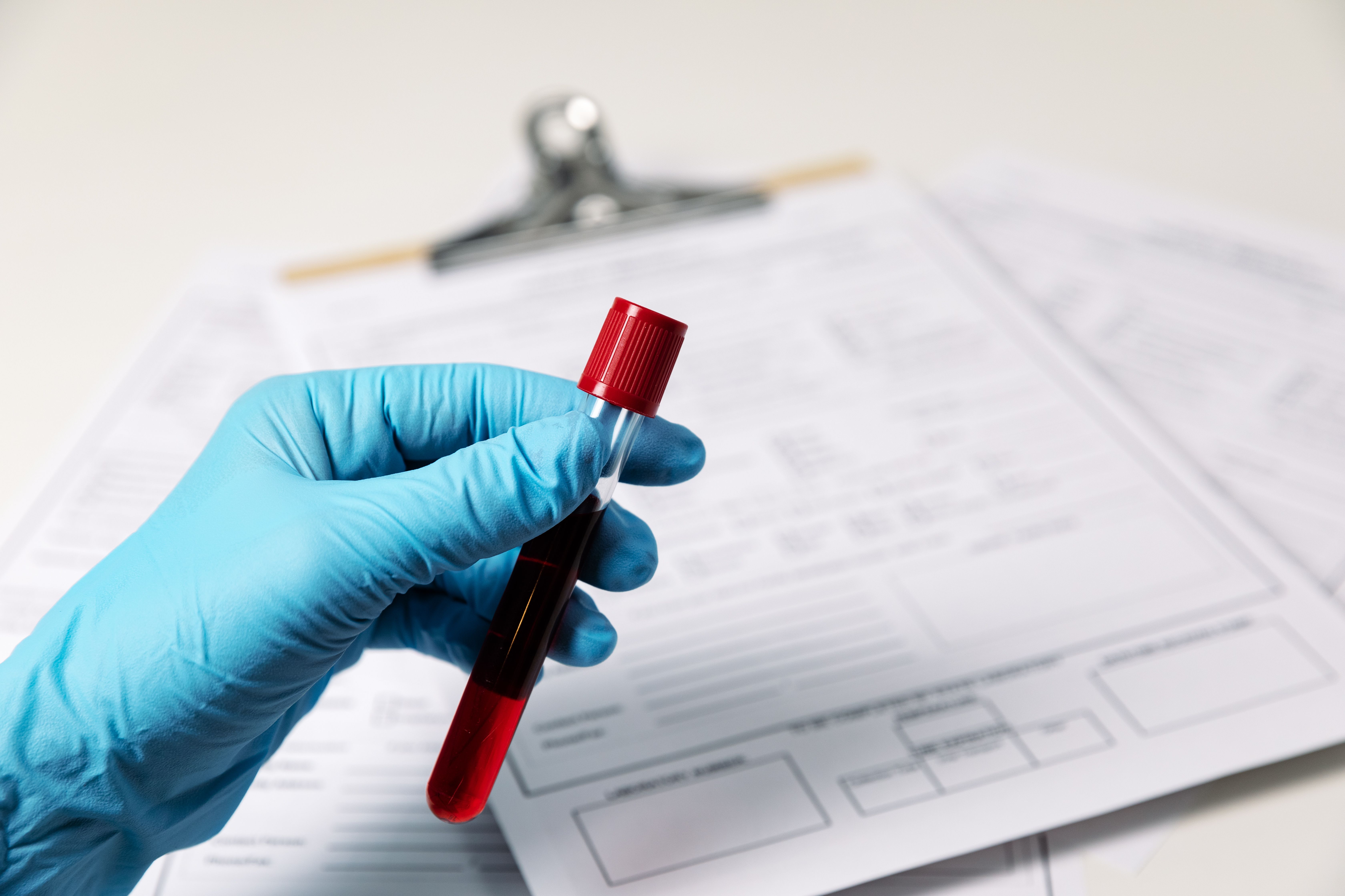 A gloved hand holds a blood sample in a test tube, with medical forms blurred in the background