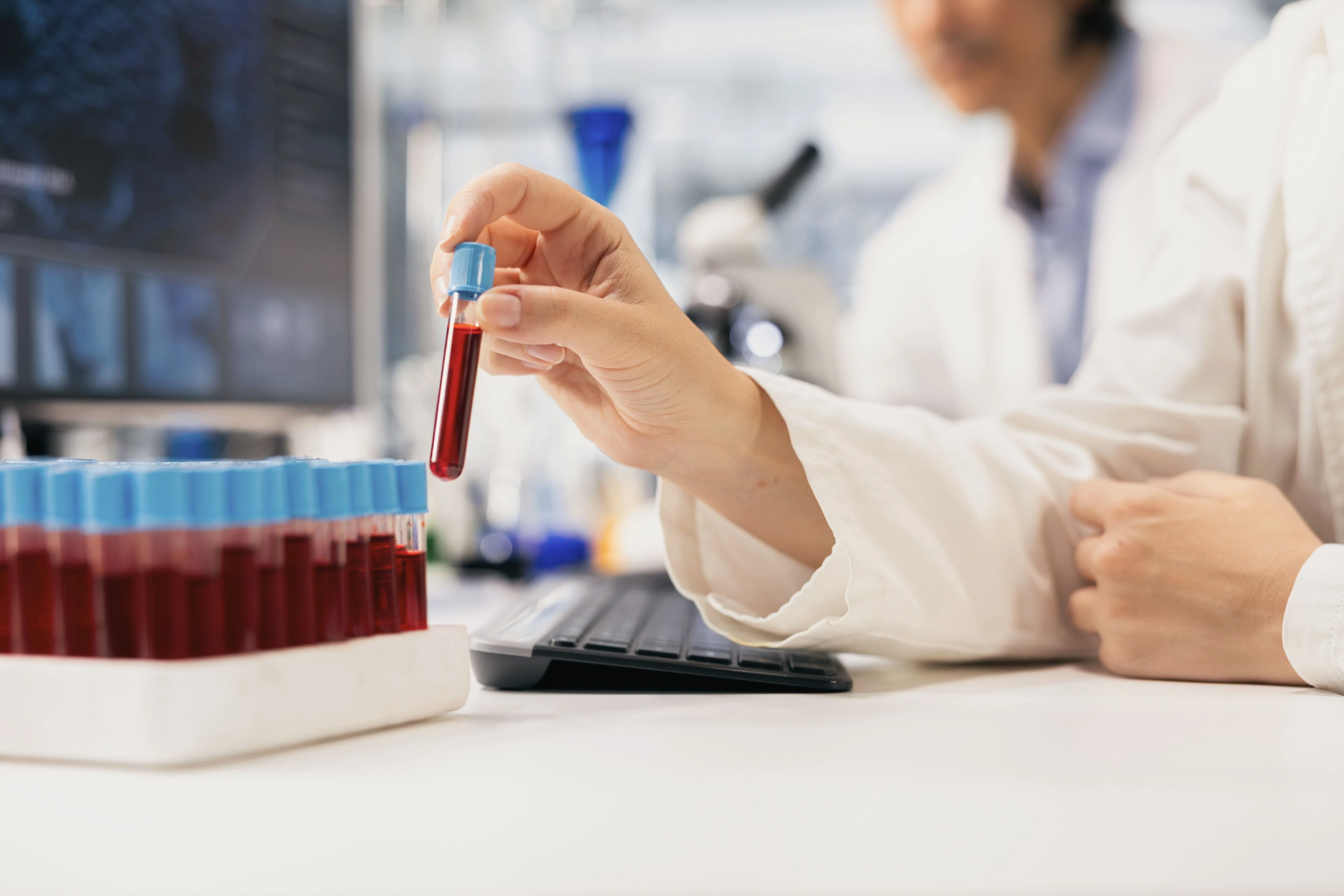 Tubes à essai pour analyses sanguines