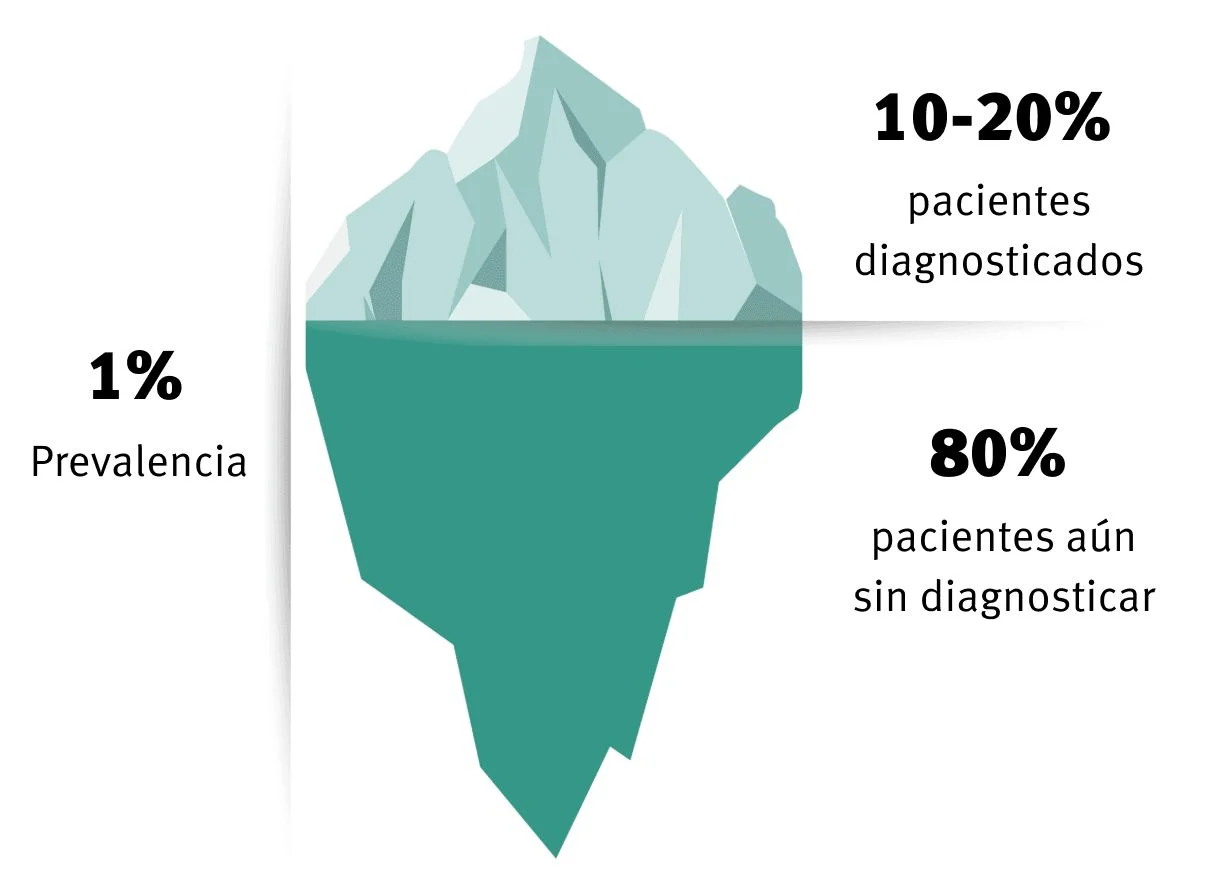 Ilustración de un iceberg con estadísticas: 1% de prevalencia, 10-20% diagnosticados, 80% aún sin diagnosticar