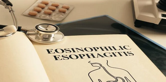 Un libro médico abierto en la página de esofagitis eosinofílica, con un estetoscopio y un microscopio cerca